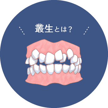 叢生とは？