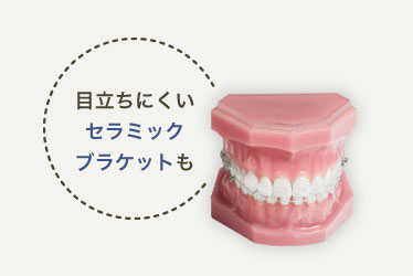目立ちにくいセラミックブラケットも