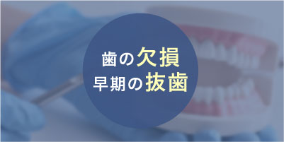 はの欠損・早期の抜歯