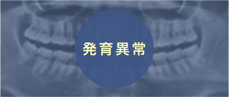 発育異常
