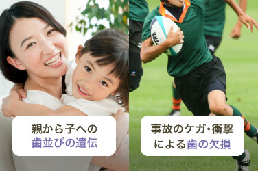 親から子への歯並びの遺伝／事故のケガ・衝撃による歯の欠損