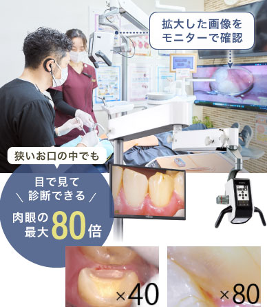 狭いお口の中でも目で見て診断できる肉眼の最大80倍！拡大した画像をモニターで確認