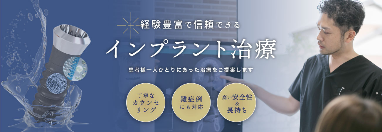 経験豊富で信頼できる インプラント治療 患者様一人ひとりに合った治療をご提案します