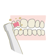 歯のクリーニングと自宅での使用法を説明します